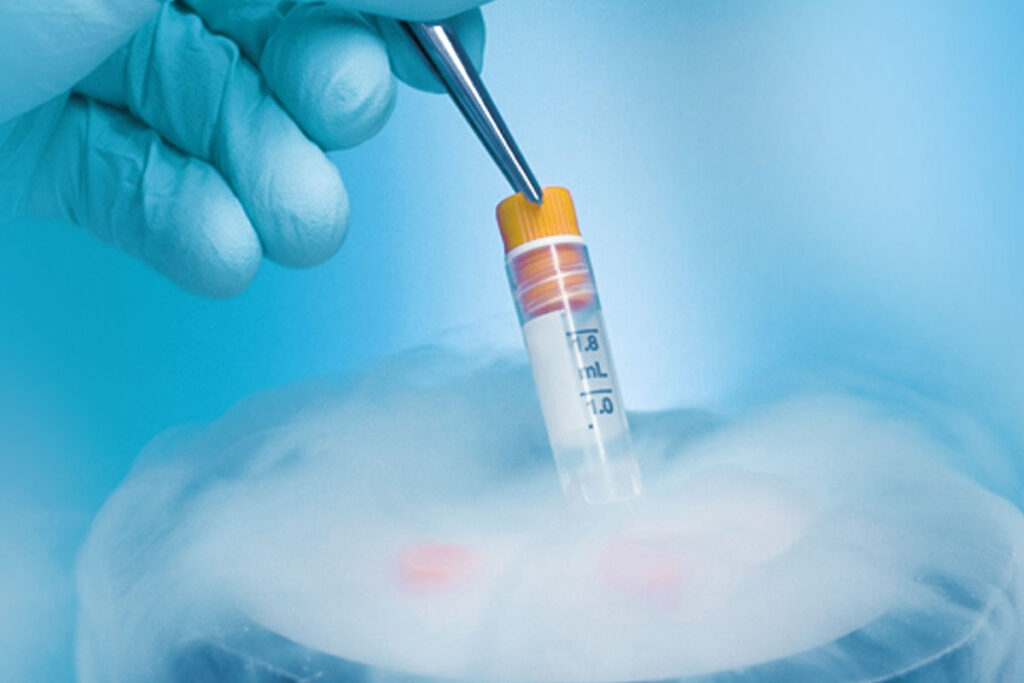 what-is-frozen-embryo-transfer-techgib